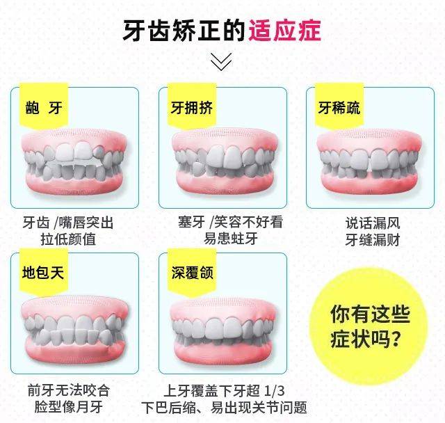 人口中牙数量_中国人口数量变化图(2)