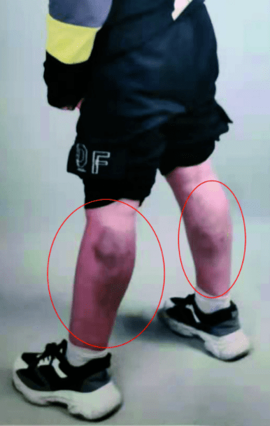 aefccd8139a341198bbb69526c13a2f8.png