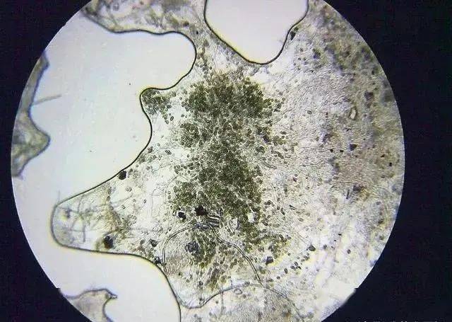 显微镜下的水霉孢子囊