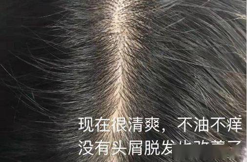 如何杀螨虫和跳蚤 e7f8cb4973e34901a4254460a5a49e70.jpeg