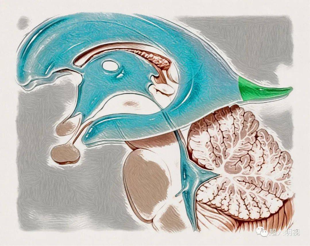 纵切面 上图:从前往后看,脑室是这个样子的 上图:黄色代表脉络丛位置