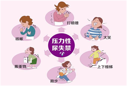 成人口肌训练_口肌训练图片