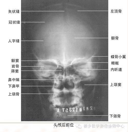 x线入门丨x线解剖,这里基本全了,工作必备