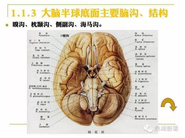 值得收藏!高清头颅mr解剖图谱