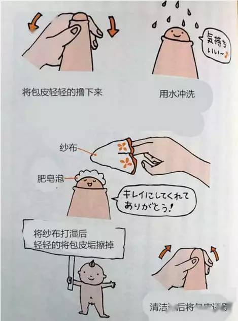 孩子割包皮这件事,影响很严重!家长必看