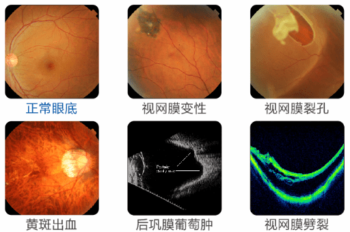 2021近视人口_预防近视手抄报(2)