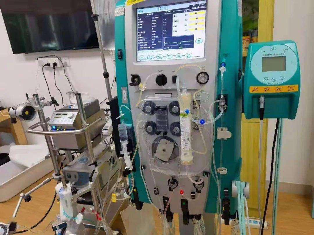 聚焦救命神器来了晋江市医院引进首台人工肺