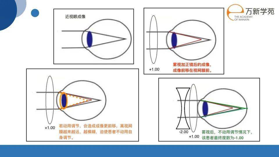 微课堂雾视验光的重要性