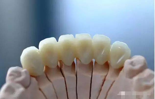 揭秘:为什么牙医要您做氧化锆全瓷牙?