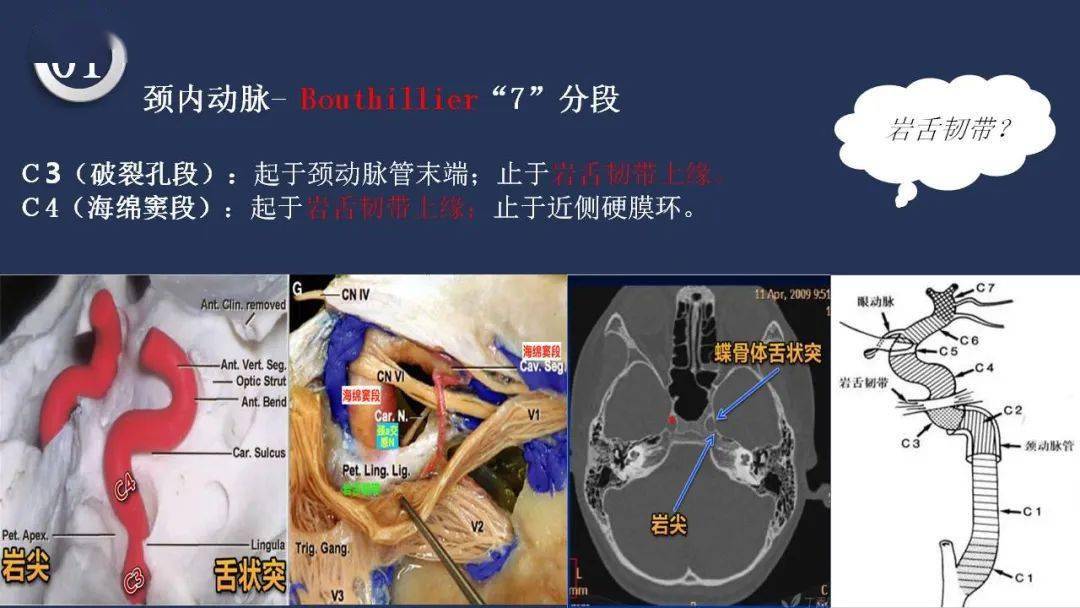 头颈动脉系统相关解剖