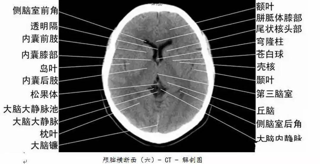 全身ct图谱,赶紧收藏了吧