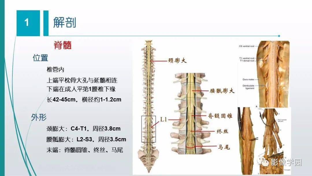 脊髓和椎管内病变的影像学诊断