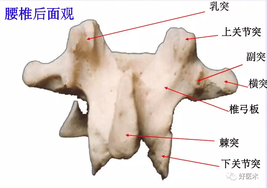 腰段椎管的形状:从上而下为卵圆形----三角形---三叶形