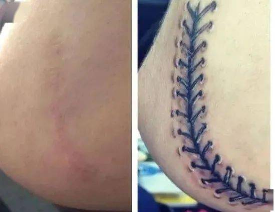 纹身遮盖疤痕的危害有多大?这些你可能想都想不到