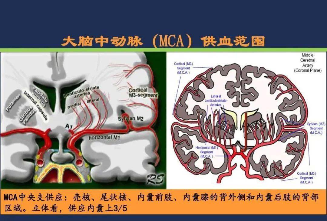 从梗死部位推测责任血管:脑血管解剖_动脉