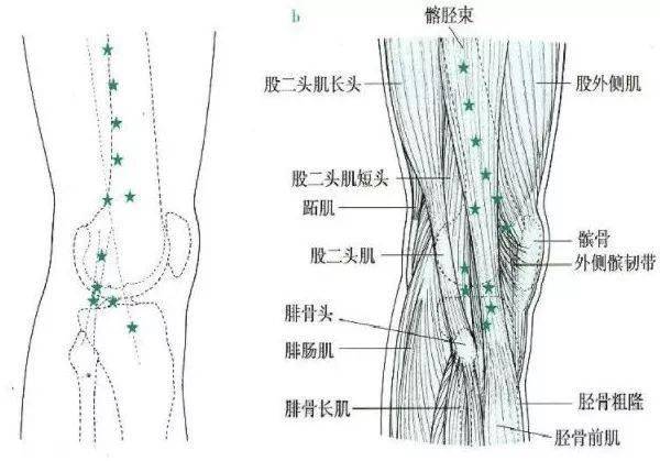 膝关节内侧压痛点膝关节前部压痛点oa膝关节压痛点腘绳肌 腘绳肌止