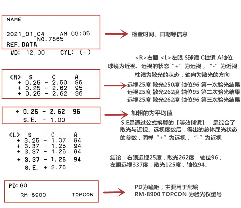 验光单上写的都是啥?看懂这几项就够了