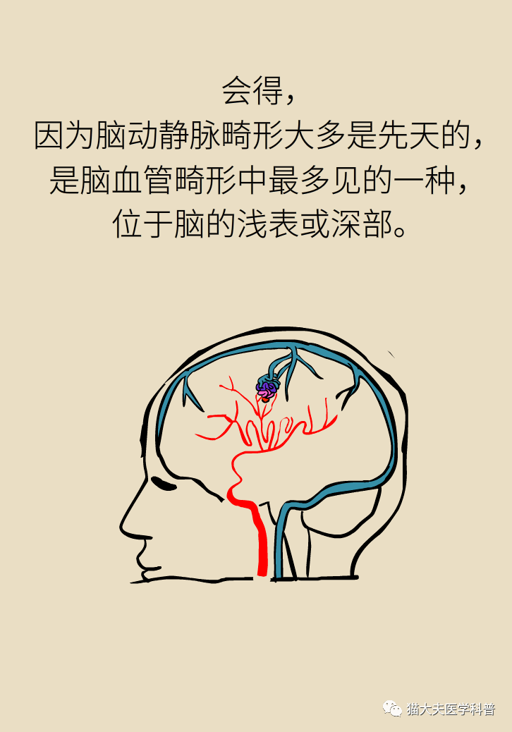 脑血管畸形是什么鬼?是天生的吗?