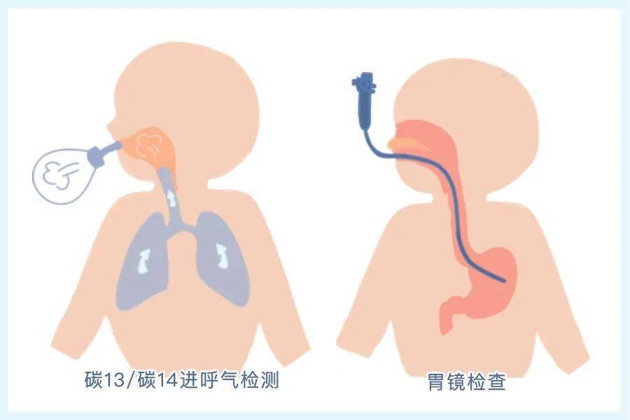 六,关于c-13尿素呼气试验