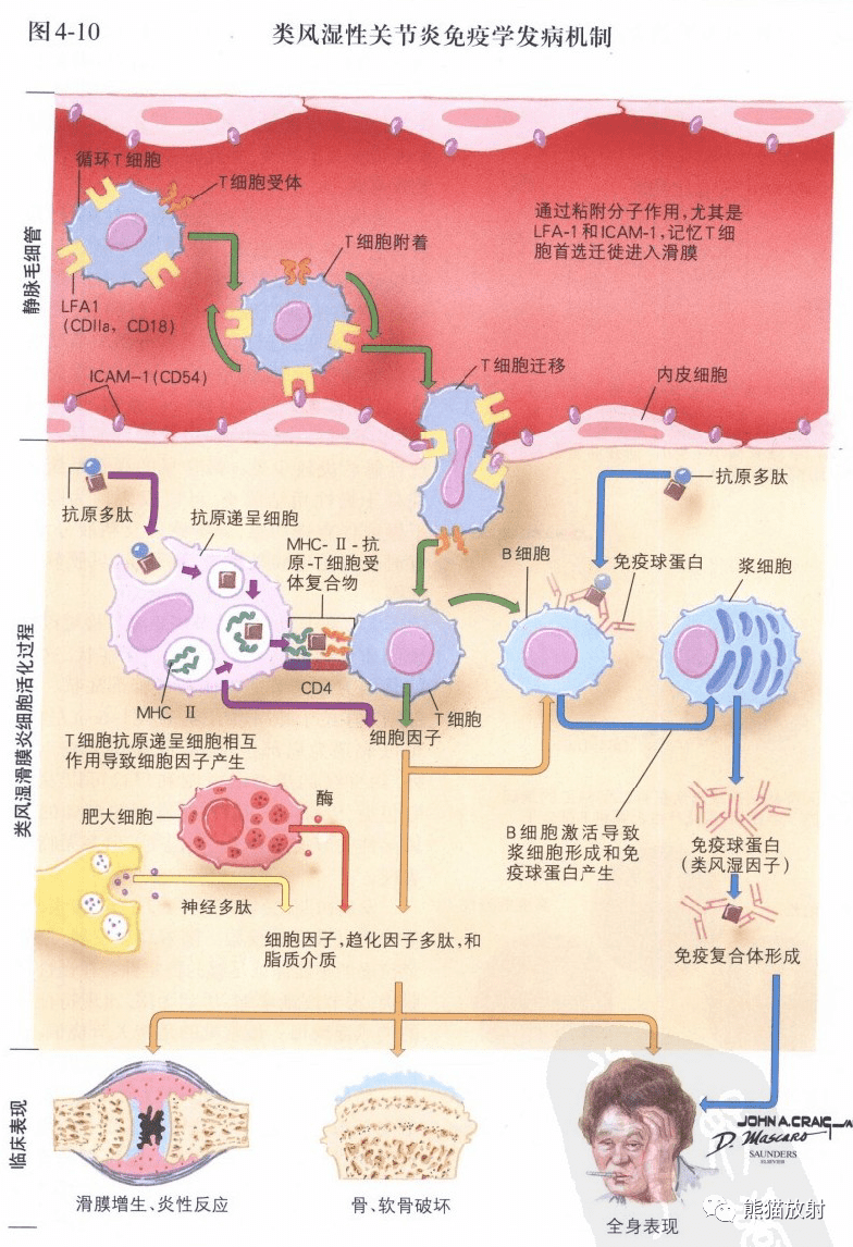 内容包括: 骨关节炎,类风湿关节炎, 强直性脊柱炎,等.