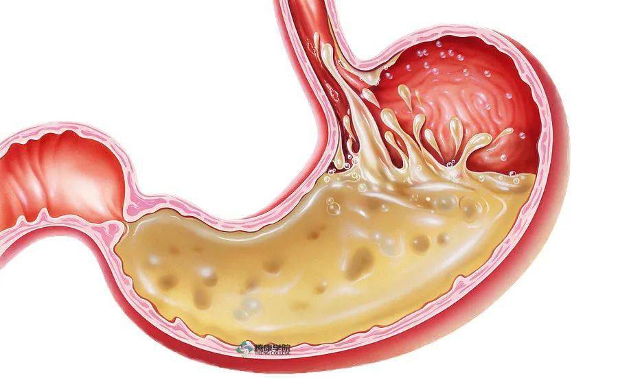 胃酸是由胃壁细胞分泌,正常人壁细胞总体有一个正常数值(男性约10亿