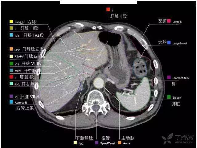 收藏史上最全的ct断层解剖图谱一篇所有都有