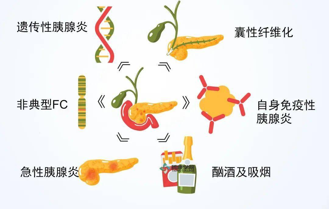 慢性胰腺炎