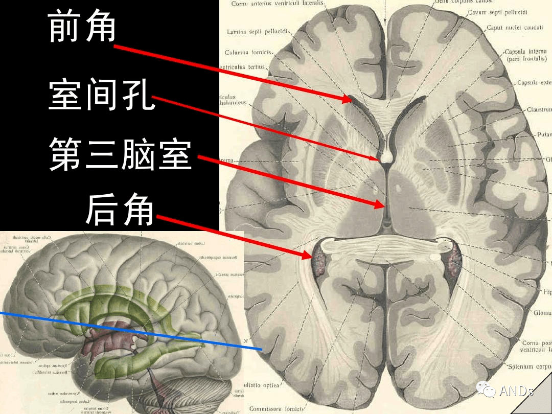 高清解剖脑室脑池脑膜