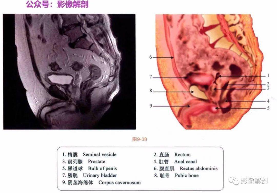 断层图谱 | 男,女性盆腔解剖图谱