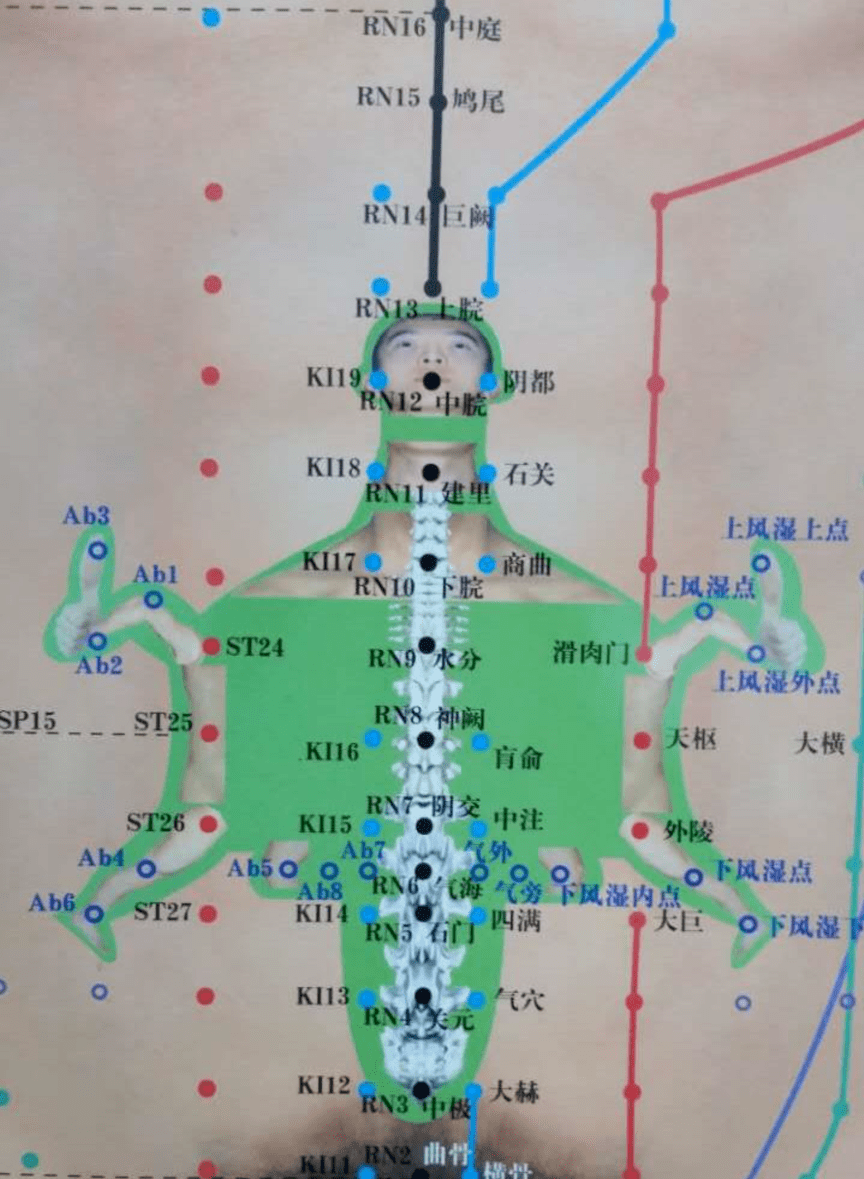 中医特色|腹针疗法真神奇,针在腹部效管全身_治疗