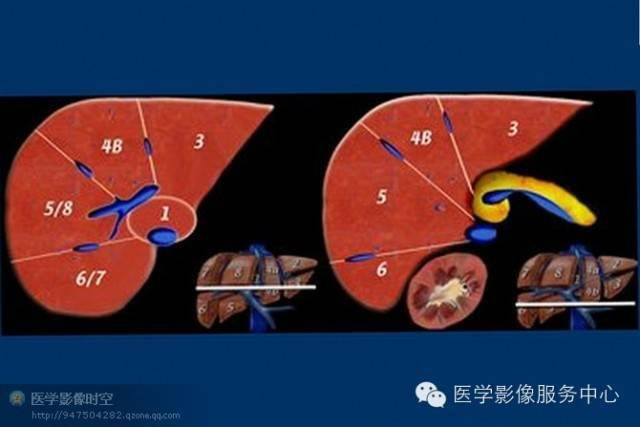 影像必备丨最全肝段解剖图解