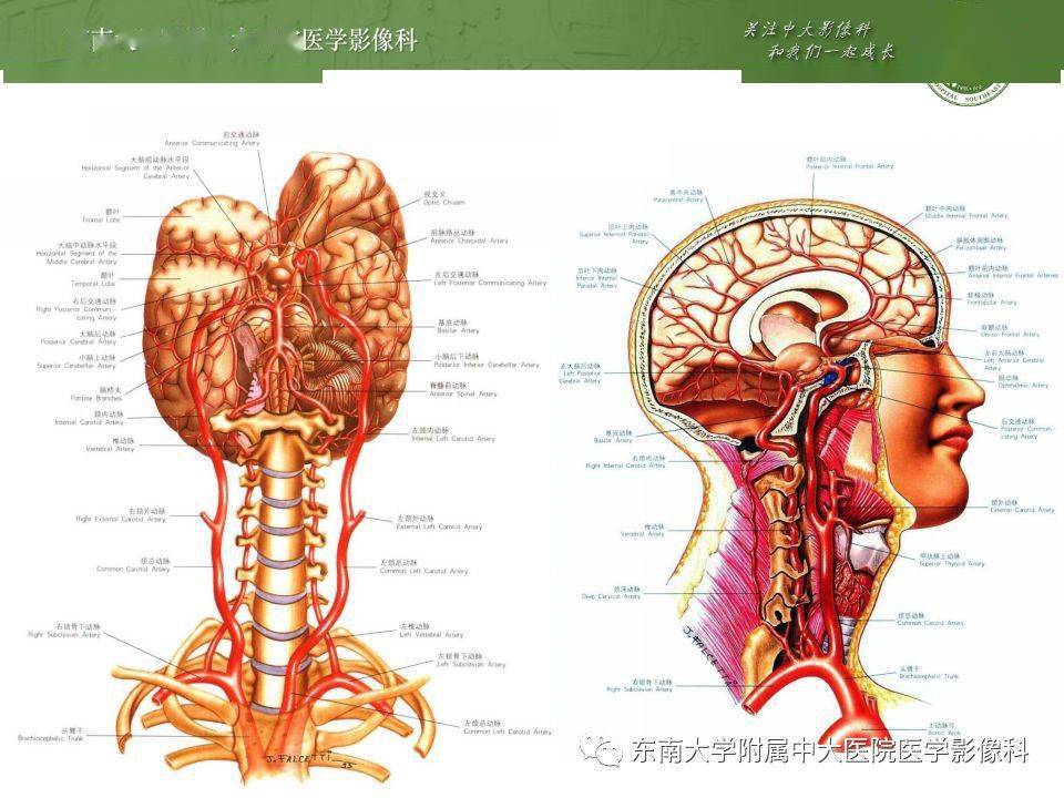 解剖| 头部血管解剖及willis环常见变异