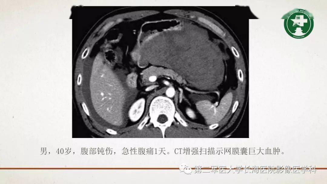 腹膜相关结构的影像解剖