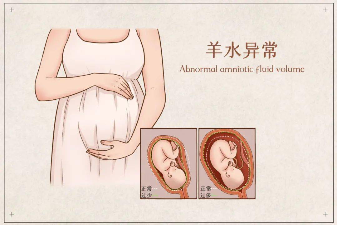 厦门女子:在医院看到一个孕妇一走路羊水就破,胎儿保不住了!