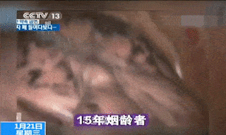 3包烟就能熏黑一个肺十年烟龄的大佬都戒烟了你还不戒