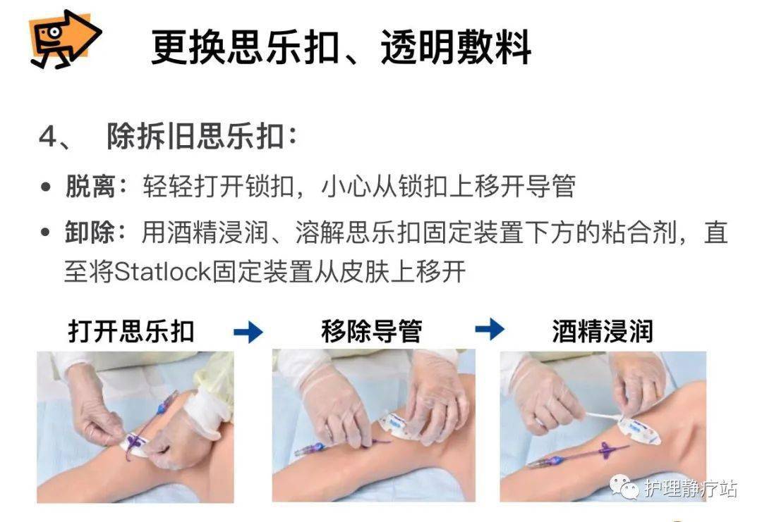 正压封管—picc维护的重要步骤,你做对了吗?_护理