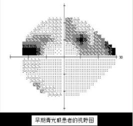 视野不丢生活无忧眼耳鼻咽喉口腔中心世界青光眼周义诊活动等您来