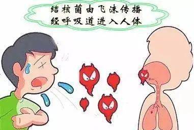 科普在线:防治肺结核,你我共参与
