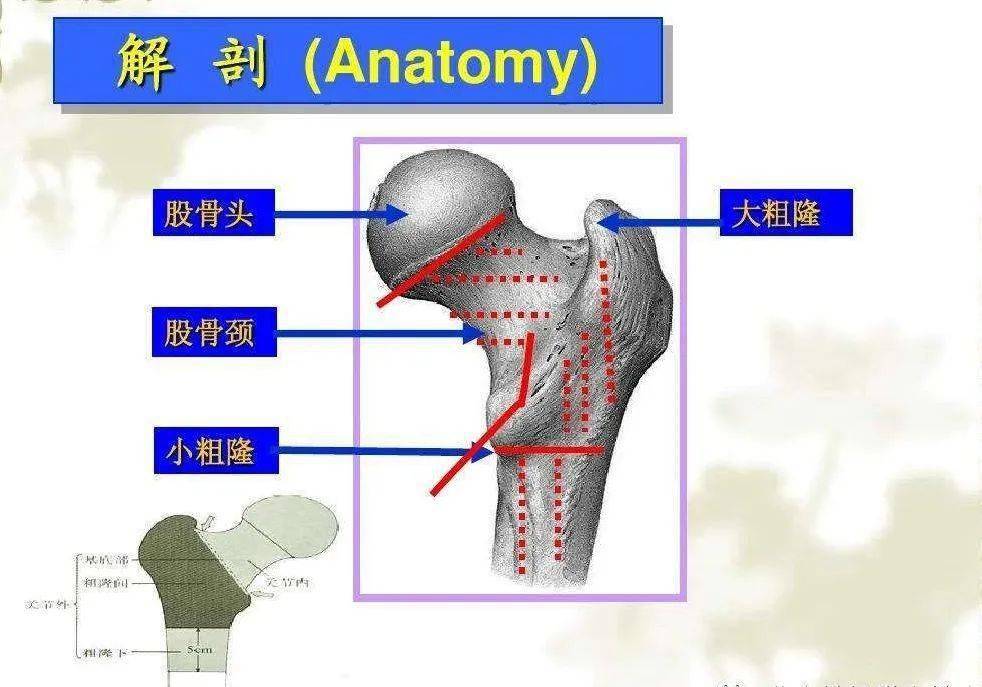 百岁老人骨折手术后站起来了!竟然还能搓麻将!