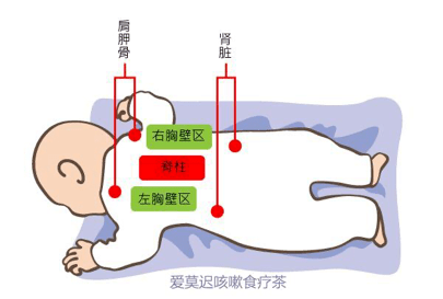 丽医科普丨小儿喉咙咕噜咕噜有痰咳不上来怎么办?(上)