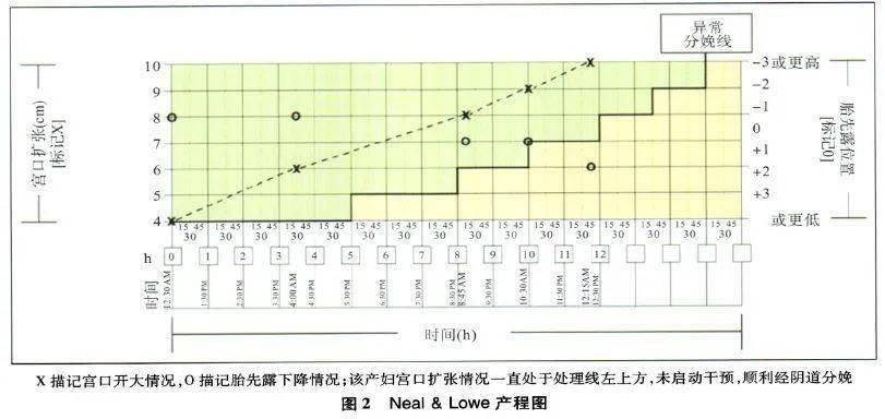 新产程标准下,是否还需要绘制产程图?