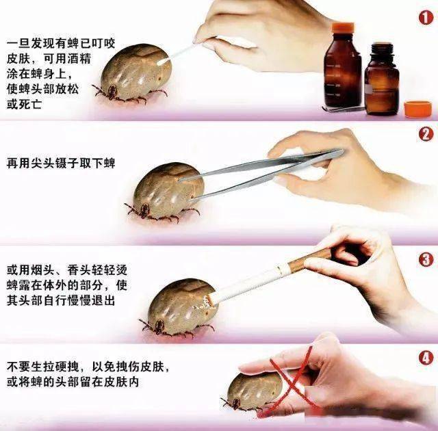 注意进入蜱虫叮咬高发季不小心会致命