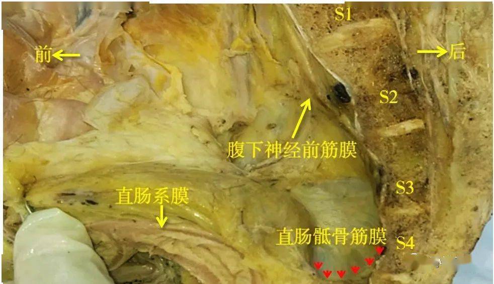 医学笔记直肠骶骨筋膜的应用解剖图文