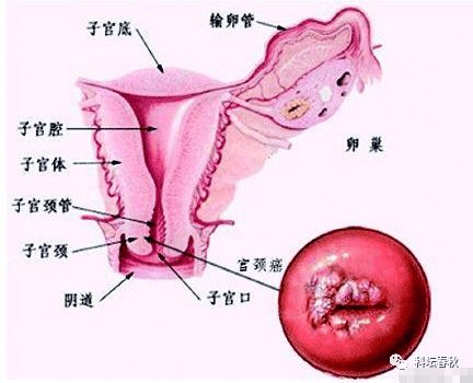 令人生疑的医学悬案,一个晚期癌症患者临死前居然可以