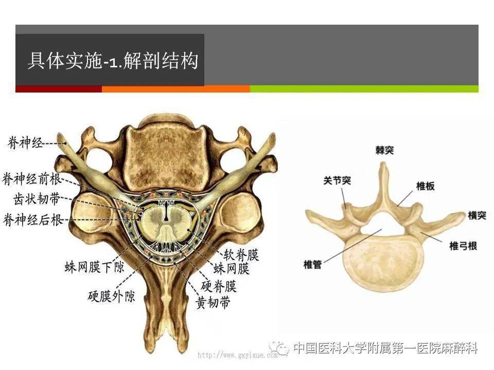 超声辅助椎管内穿刺-在产科麻醉中的应用