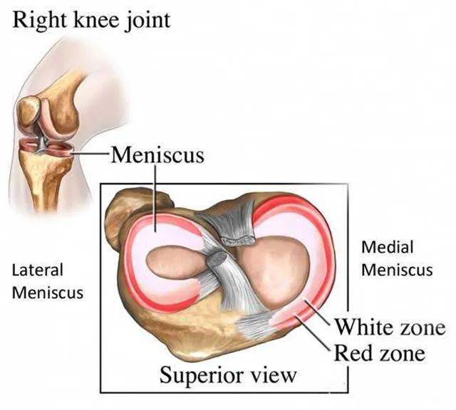 半月板红白区示意图