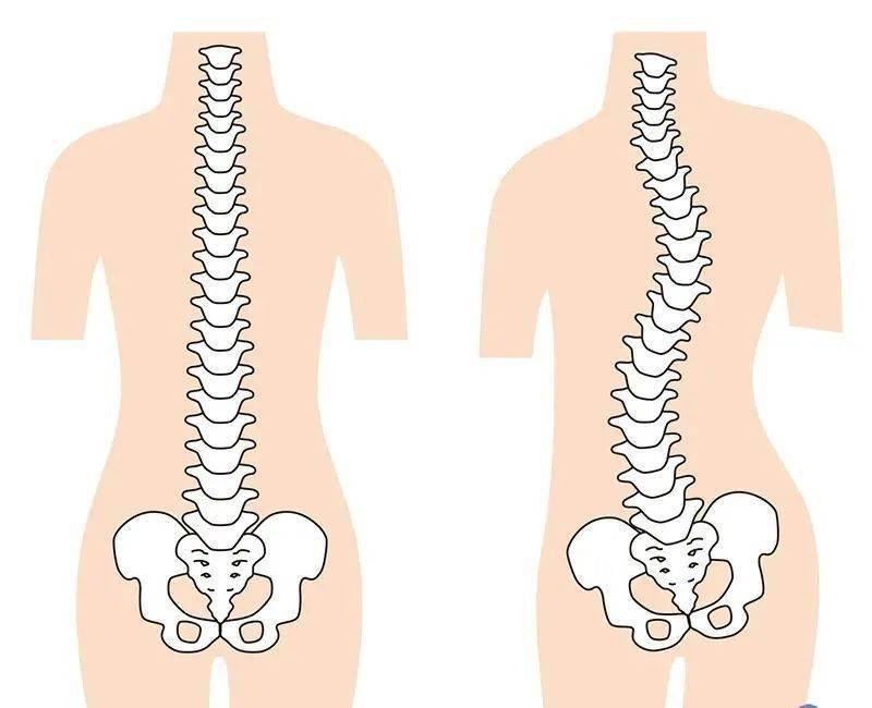 正常的脊柱有良好的生理弧度,周围的肌肉和韧带附着在脊柱上,各自
