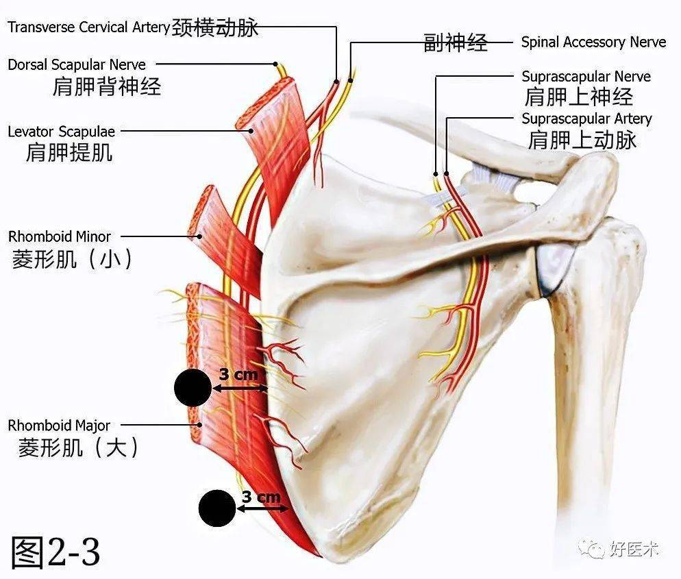 这种最容易被忽视的肩背疼痛,你真的读懂了吗?_肩胛