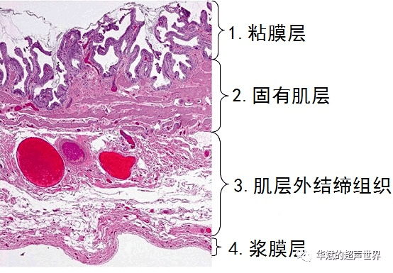 胆囊壁的组织学层次