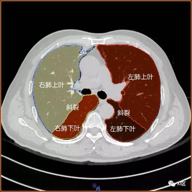 如此详细的肺部影像解剖,有点儿酷_气管